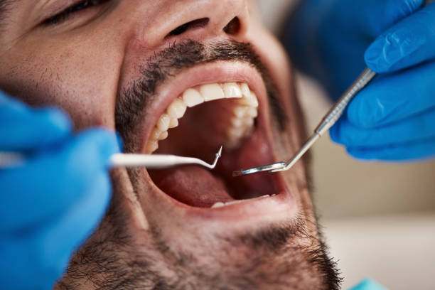 Best Cosmetic Emergency Dentistry in Dry Ridge, KY